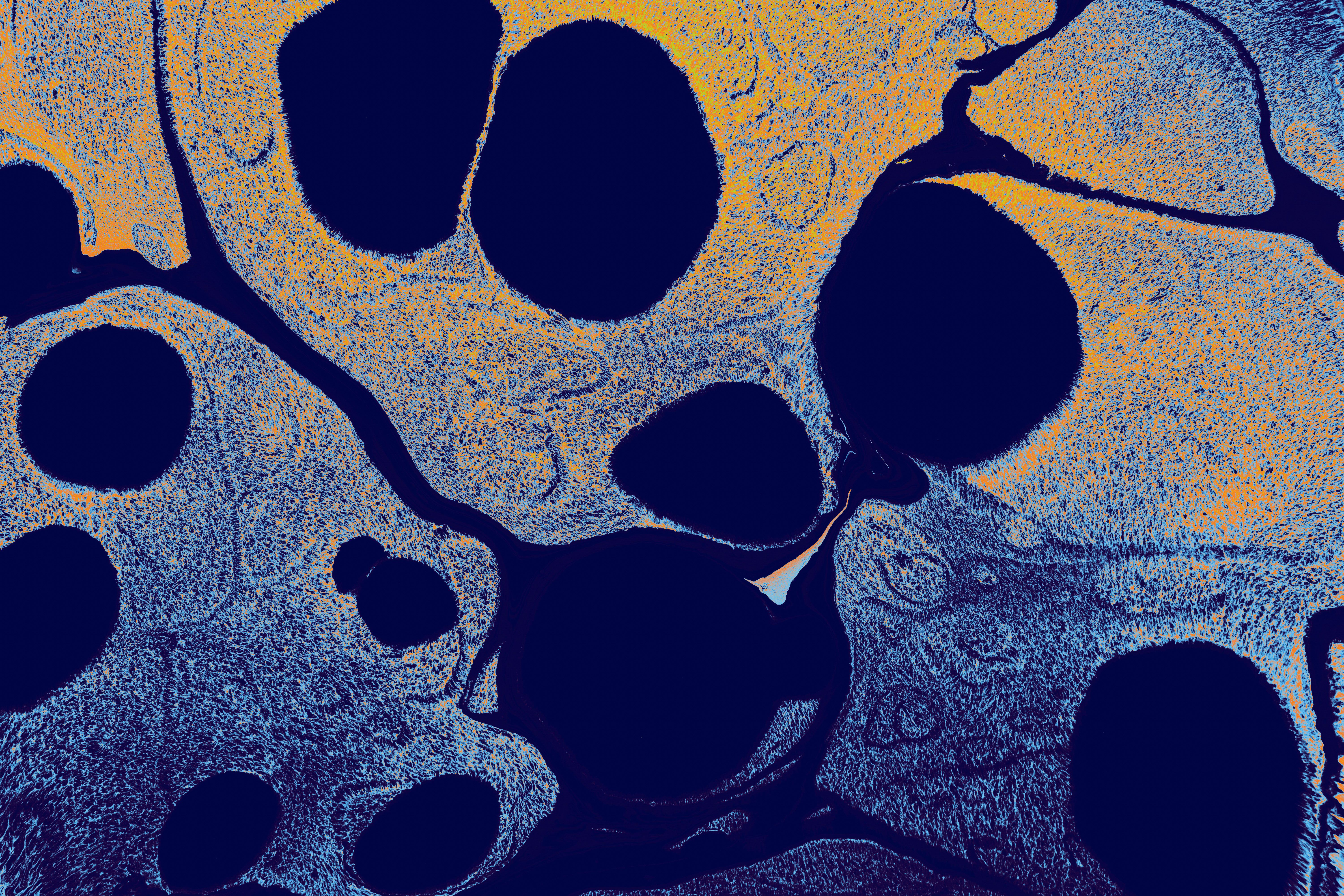 Endothelial Dysfunction — undefined