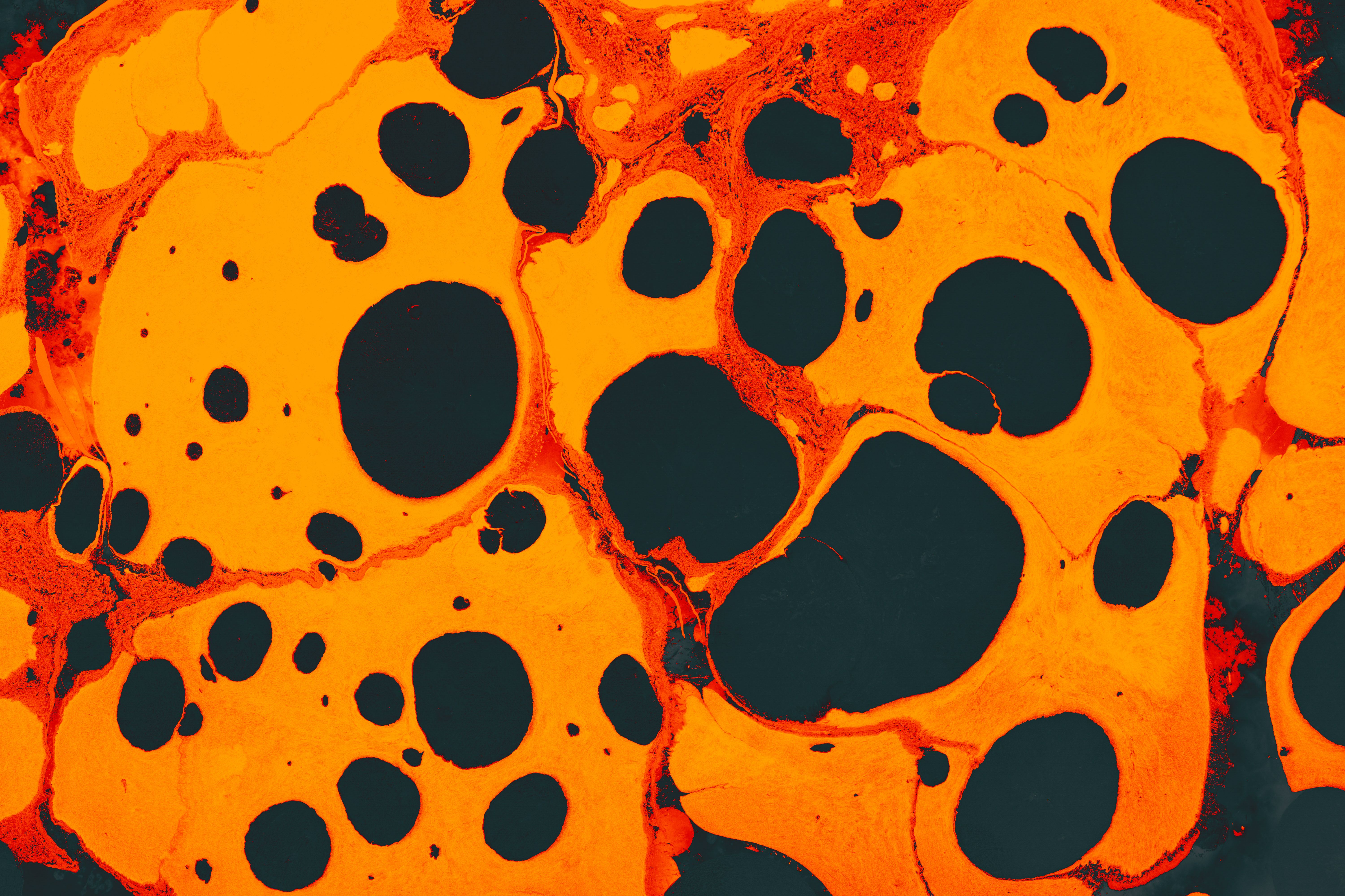 Visceral Fat — undefined